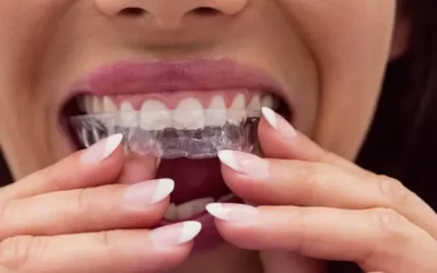 Invisalign Los Angeles: Clear Aligner Therapy for Discreet Orthodontic Correction